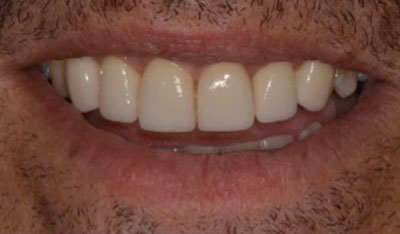 After: Cosmetic makeover