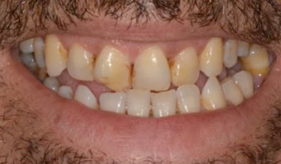 Before: Cosmetic makeover